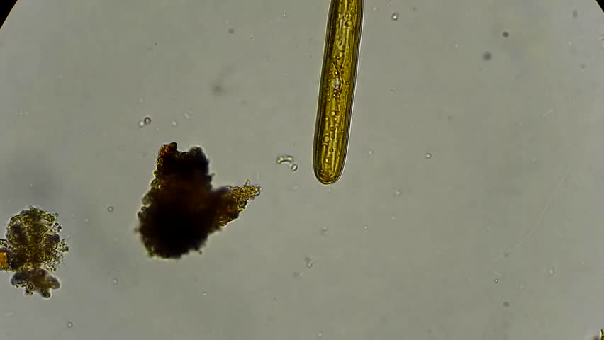 Full HD. Live Diatom Algae Under Microscope, Magnification ...