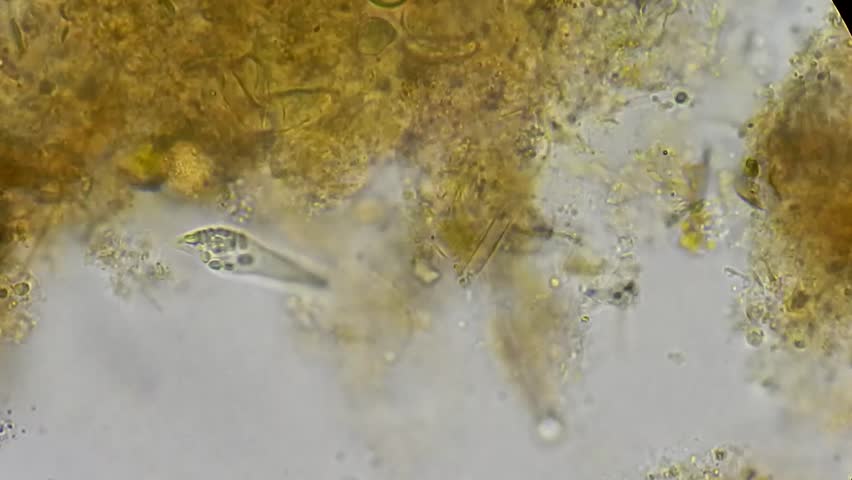 Euglen Algae Under Microscope 400x Stock Footage Video ...